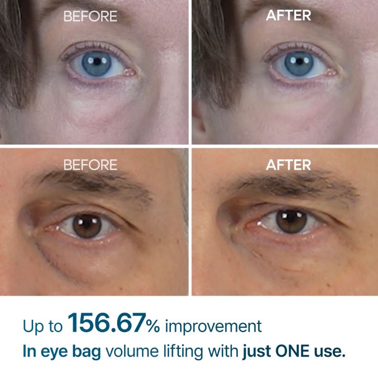 Dr.Melaxin 韓國 Eyephalt 眼袋隱形霜